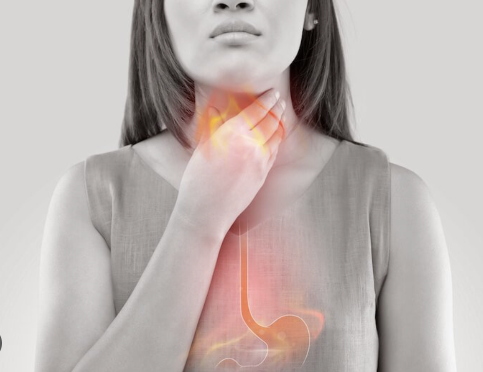 Heartburn & Acid Reflux: When It's More Than Indigestion