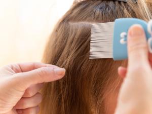 Head Lice Treatment service picture