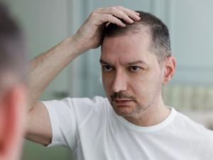 Hair Loss Treatment service picture