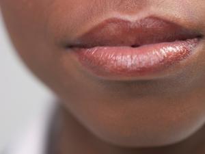 Oral Thrush service picture